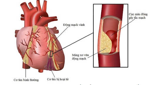 Thuốc hạ mỡ máu