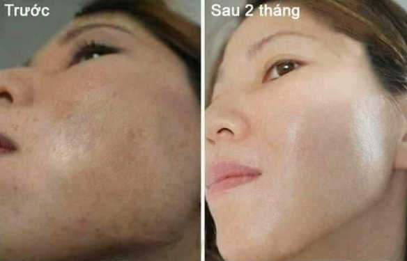 Serum Kiều