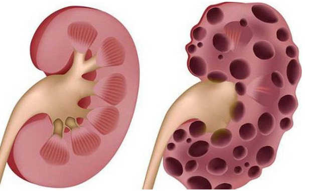 Ích Thận Vương Có Tốt Không, Giá Bao Nhiêu, Mua Ở Đâu